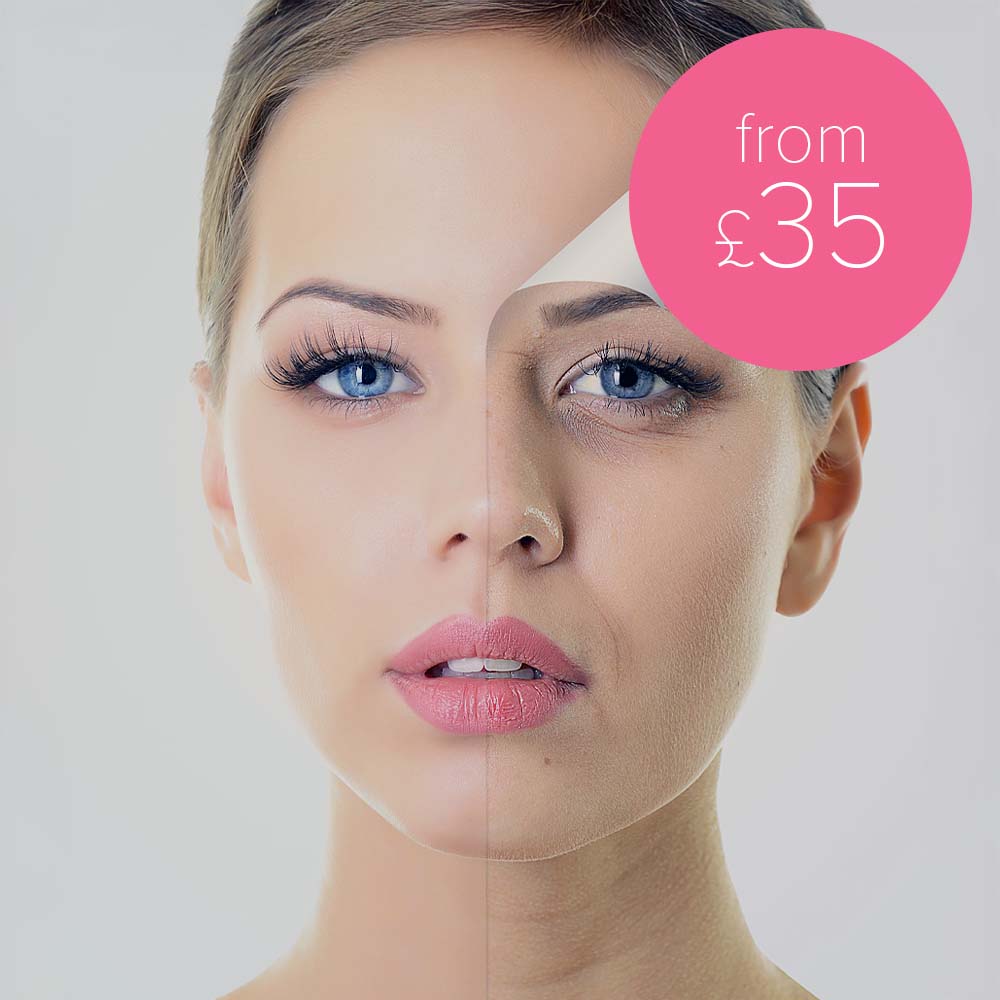 Crystal Clear Microdermabrasion Chester & Wirral