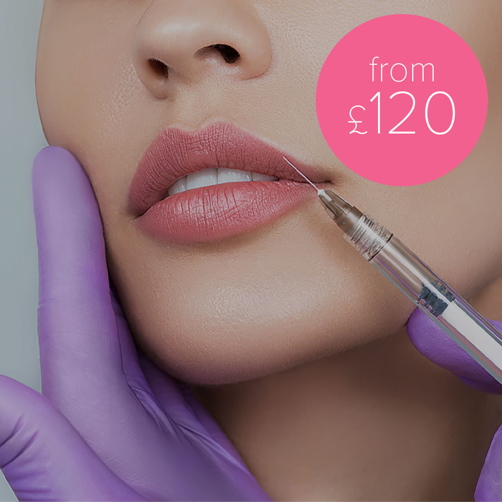 Lip & Facial Fillers Chester & Wirral