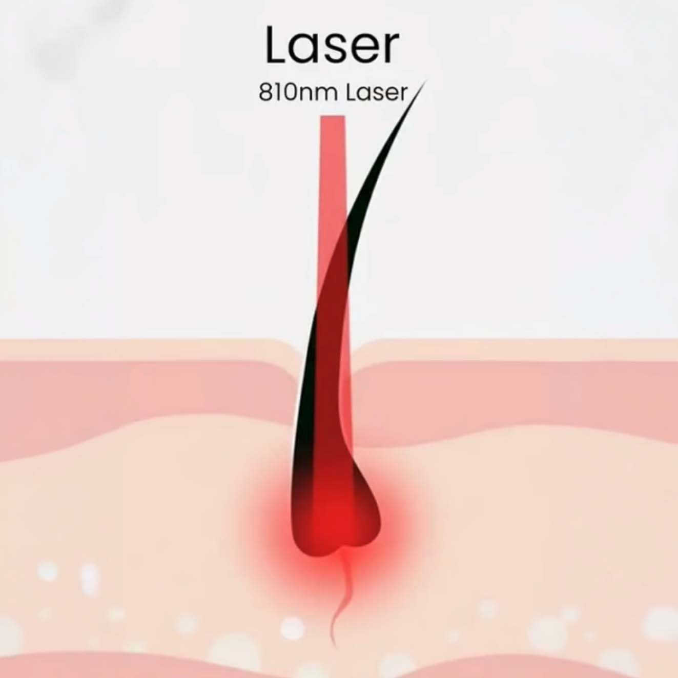 Diode Laser