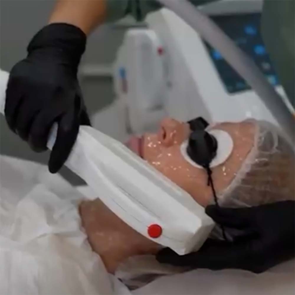 IPL Skin Rejuvenation - The Target Check