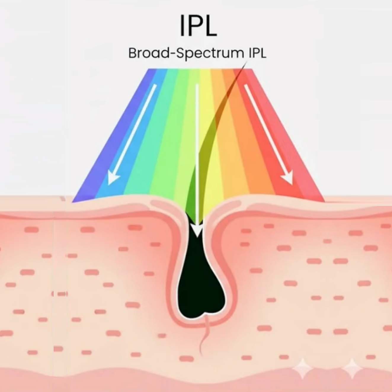 IPL