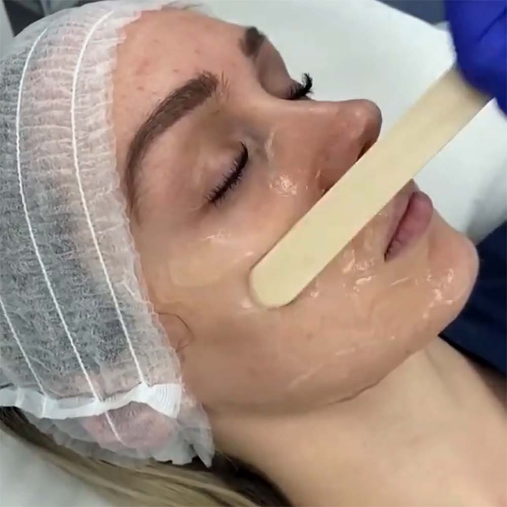 Radio Frequency (RF) Skin Tightening Coupling Gel