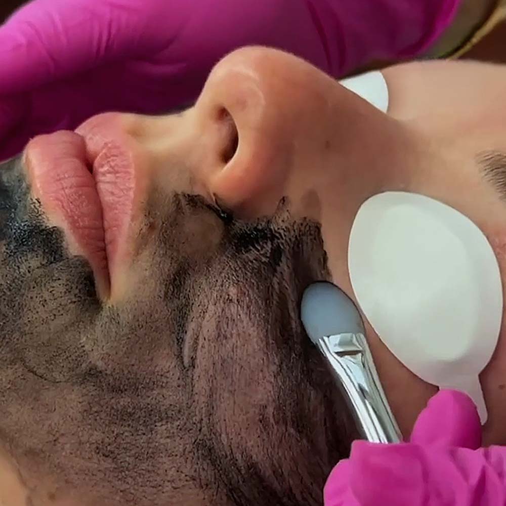 The Carbon Facial Mask